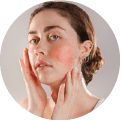 Skin Issues